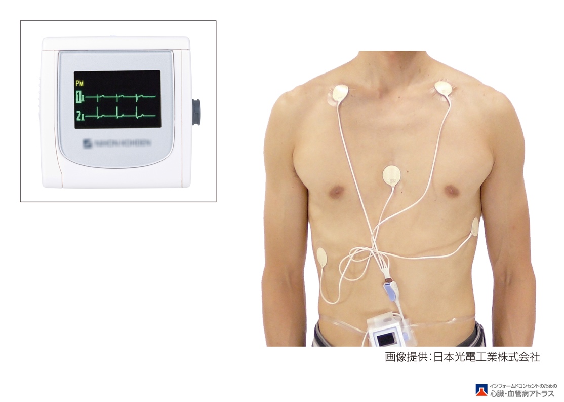 ホルター心電図、携帯心電計