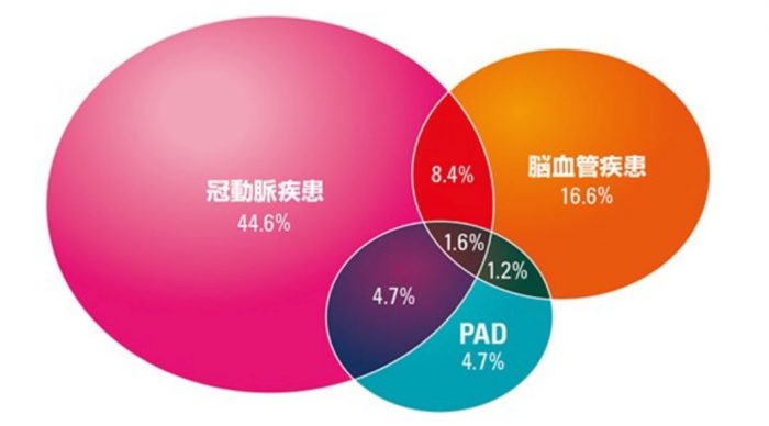 閉塞性動脈硬化症の原因